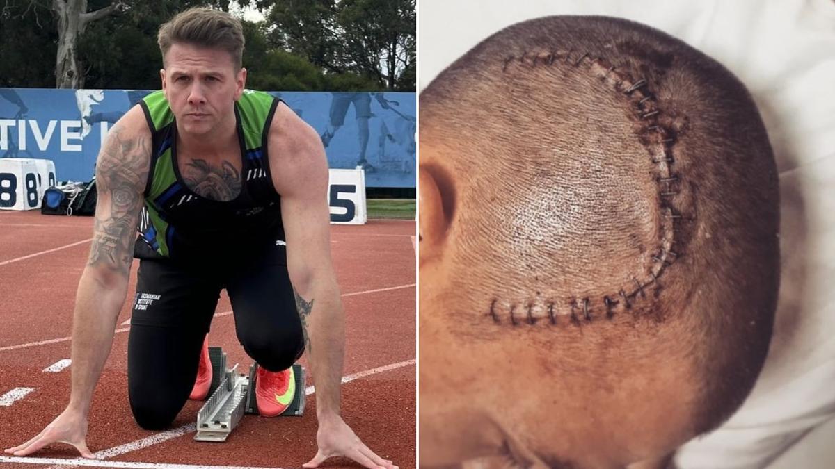 Australian para sprinter Shannon Winchester shares survival story after ...