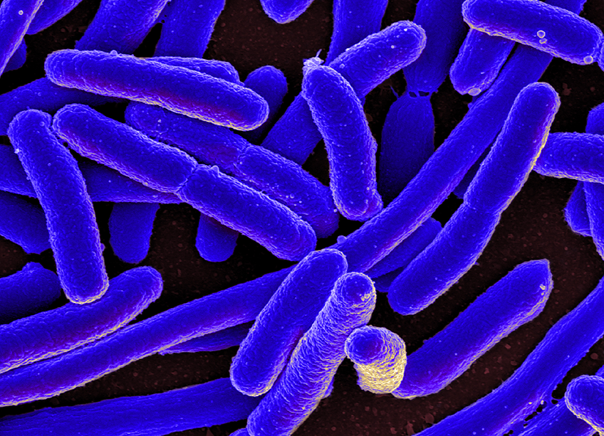 Detection Of E Coli Contamination At Lightning Ridge Australian detection-of-e-coli-contamination-at-lightning-ridge-australian