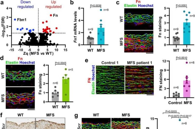 Fibronectin Pathway May Drive Marfan Aortic Damage Opening New Drug New Study Identifies K 1 768x509 